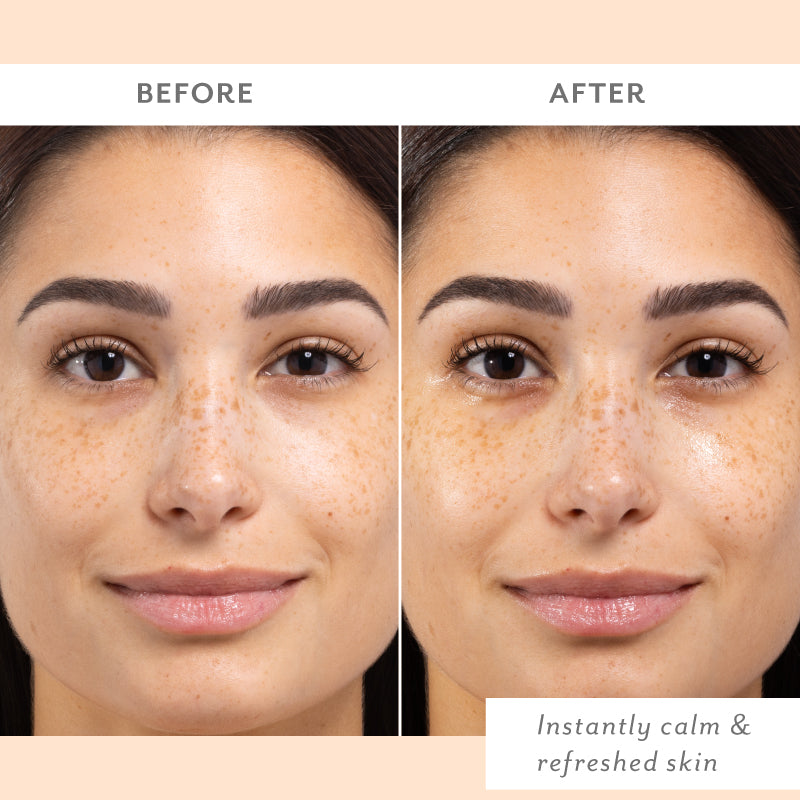 before and after skin remedy woman with brighter and less red skin visibly restored skin barrier