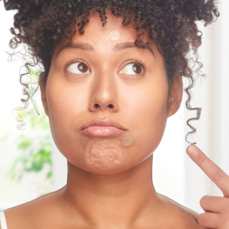 Breakout Box 3-In-1 Acne Treatment Kit