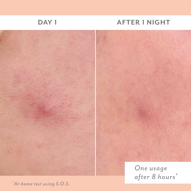Before and after comparison of skin treatment on Day 1 and After 1 Night.