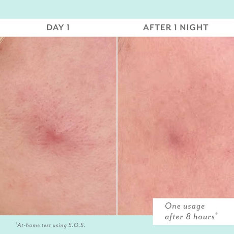 Before and after comparison of skin treatment showing a red spot on Day 1 and improved skin texture after 1 night.