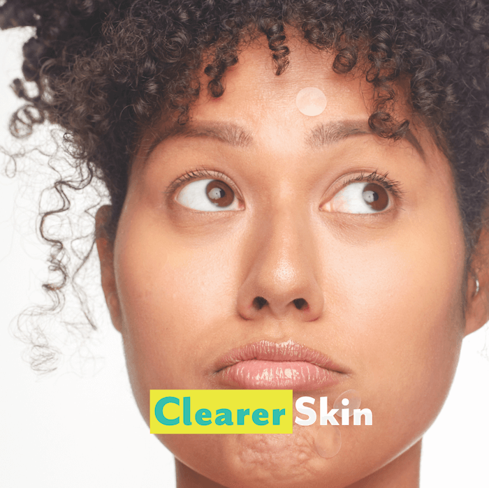 clearer skin. a woman wearing patchology pimple patches - breakout box